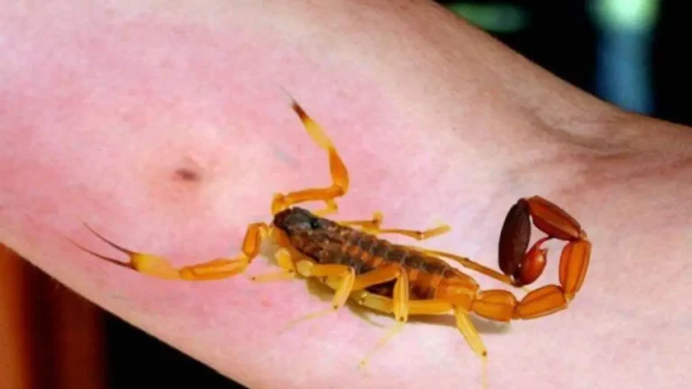 Niña de kínder en Hermosillo sufre picadura de alacrán; AEPF promueve jornadas de limpieza Niña de kínder en Hermosillo sufre picadura de alacrán; AEPF promueve jornadas de limpieza