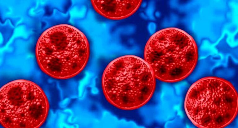 Estados Unidos reporta primeras muertes por cyclospora y más de 4 mil casos confirmados
