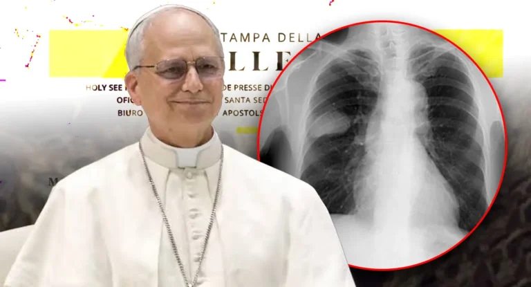 Papa León XIV es operado por cáncer de pulmón; Vaticano confirma diagnóstico